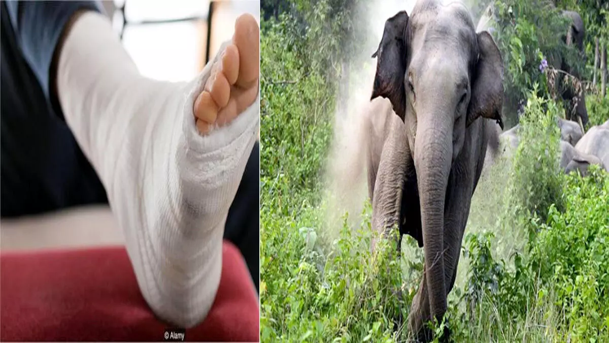 Chandil : वन क्षेत्र में जंगली हाथी के हमले से एक ग्रामीण का टूटा पैर