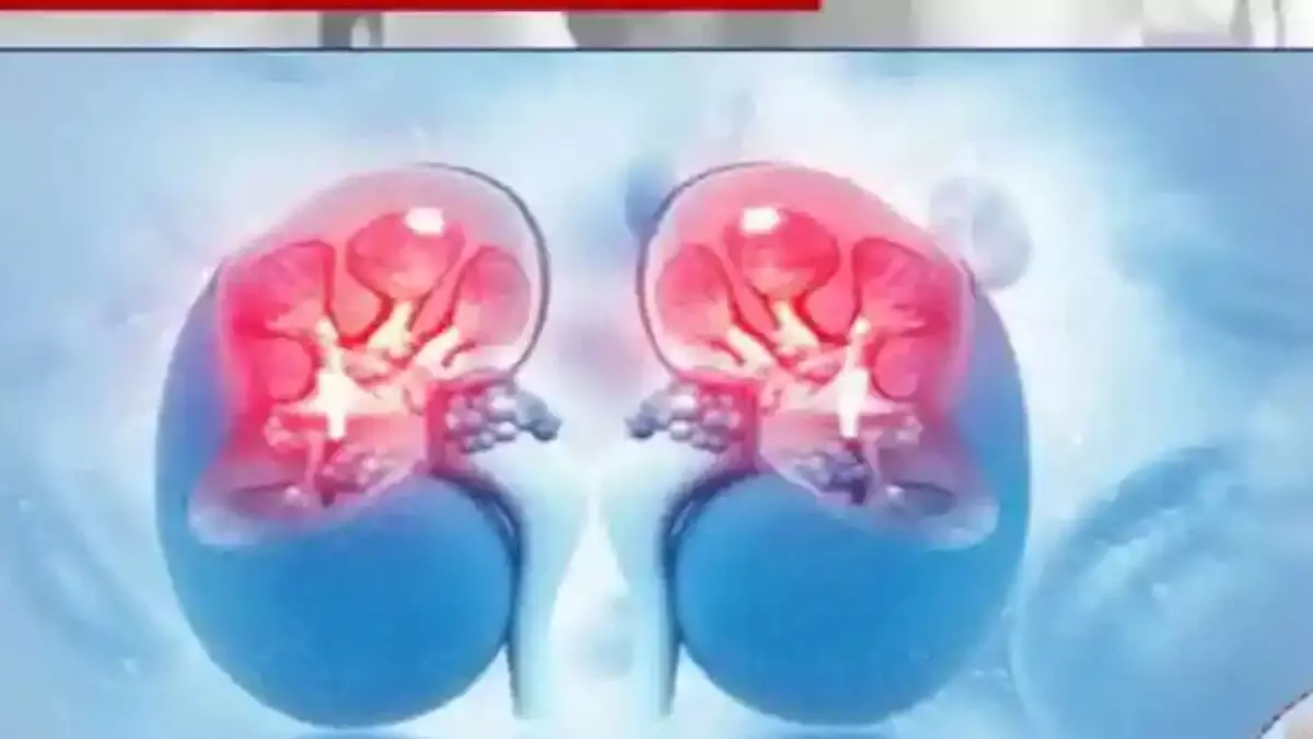 World Kidney Day: किडनी पूरे शरीर के संतुलन के लिए एक महत्वपूर्ण आंतरिक अंग, जानिए जानकारी