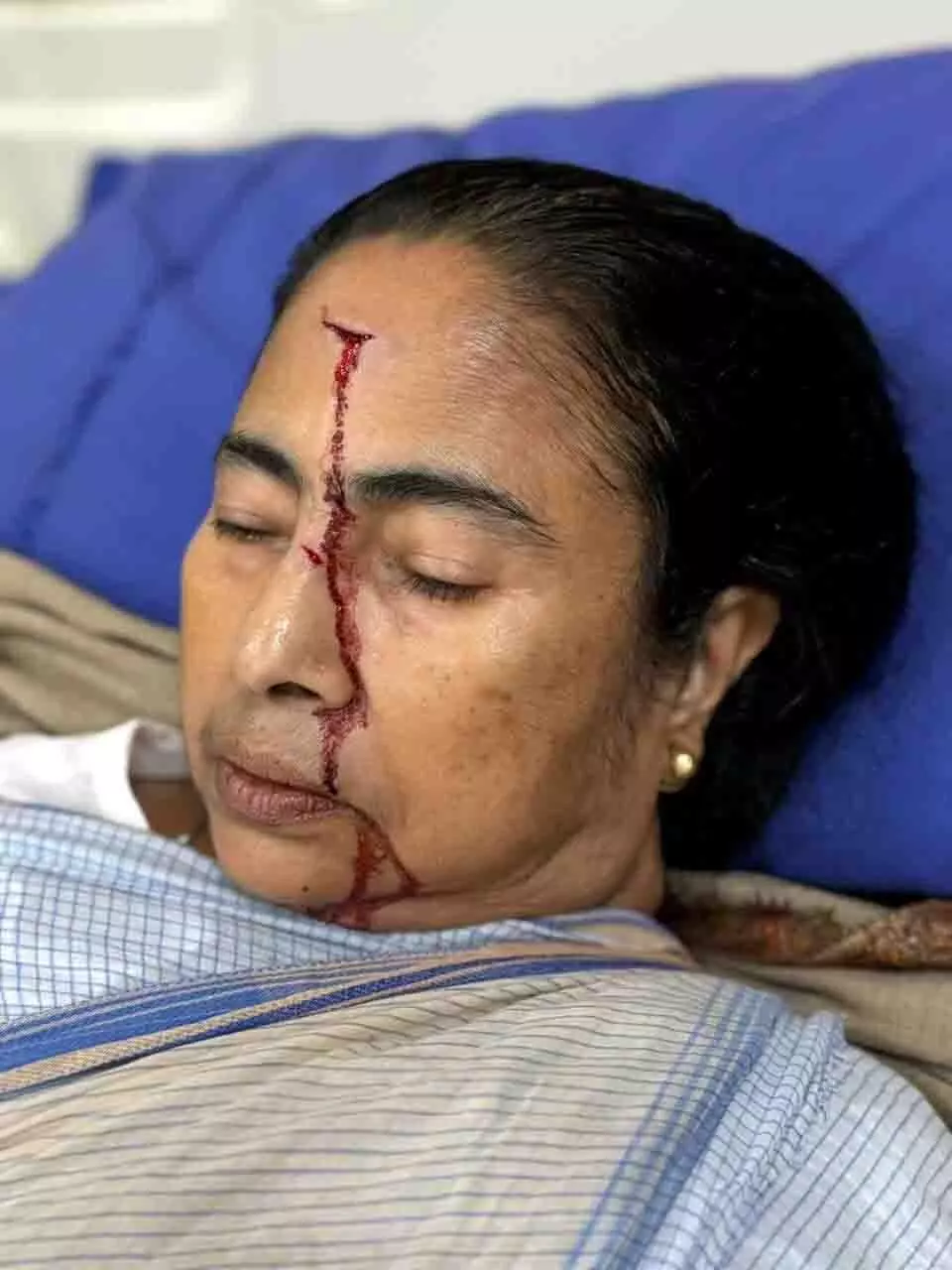 मुख्यमंत्री ममता बनर्जी को सिर में लगी गहरी चोट