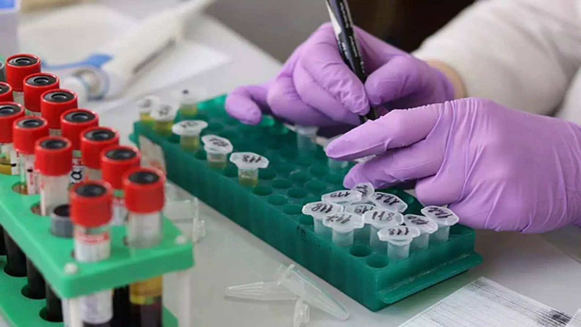वैज्ञानिकों ने इबोला वायरस को रोकने के लिए संभावित नई दवा की खोज की