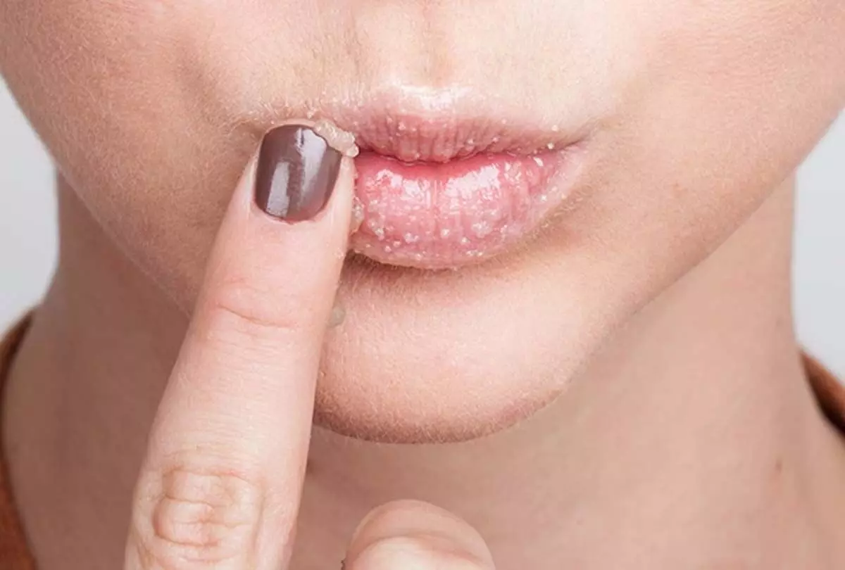 होंठों की डार्कनेस और ड्राइनेस दूर करने का असरदार उपाय