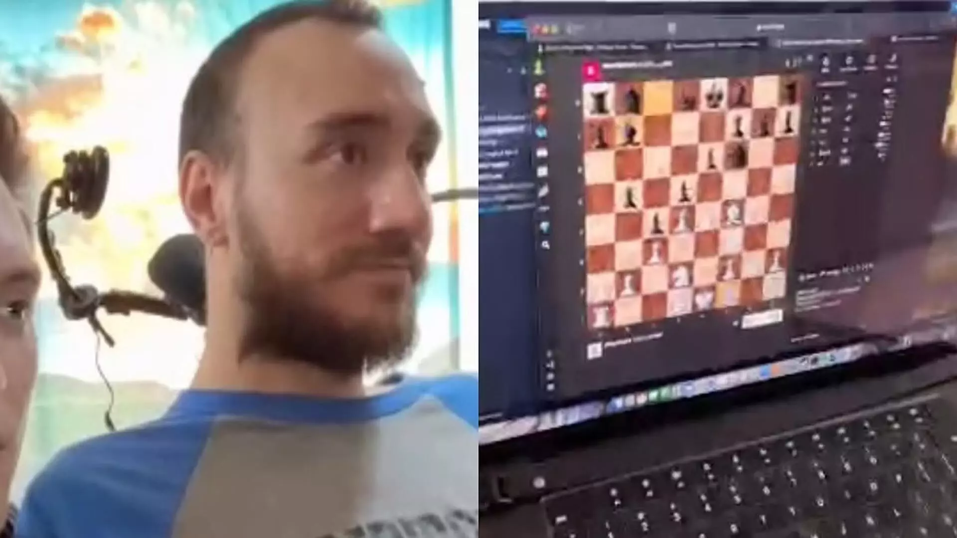 एलोन मस्क का कमाल, शख्स ने ब्रेन-चिप से खेला ऑनलाइन शतरंज