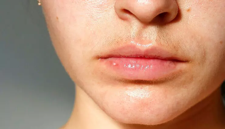 बिना थ्रेडिंग के ऊपरी होठों को साफ रखने के 10 उपयोगी टिप्स