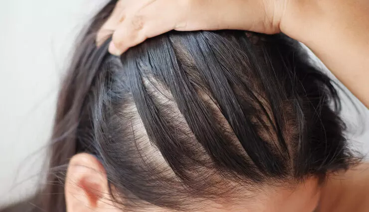 बालों को प्राकृतिक रूप से बढ़ाने के 10 सिद्ध तरीके