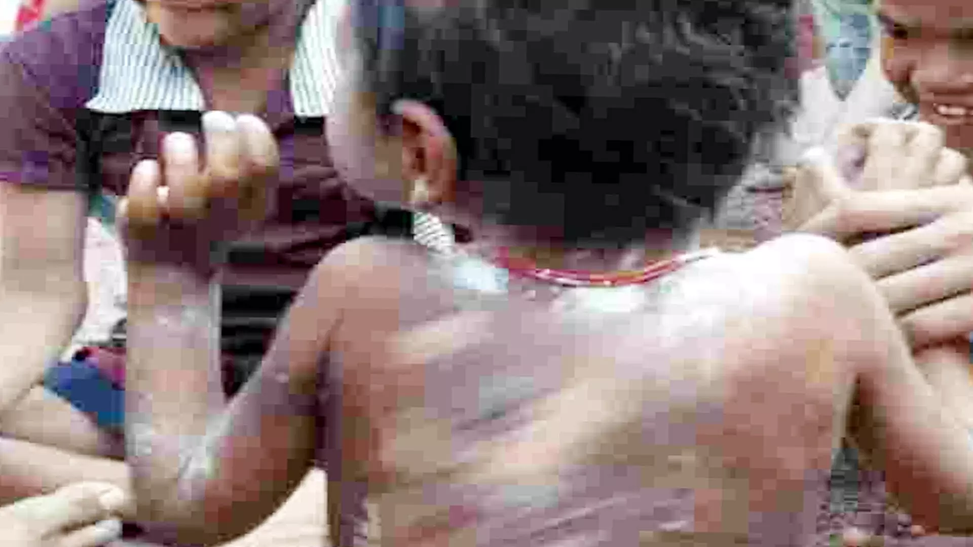 रिश्तेदार दो परिवारों के आपसी झगड़े में मासूम बच्ची पर ख़ौलता  गरम पानी,  हालत बेहद गंभीर