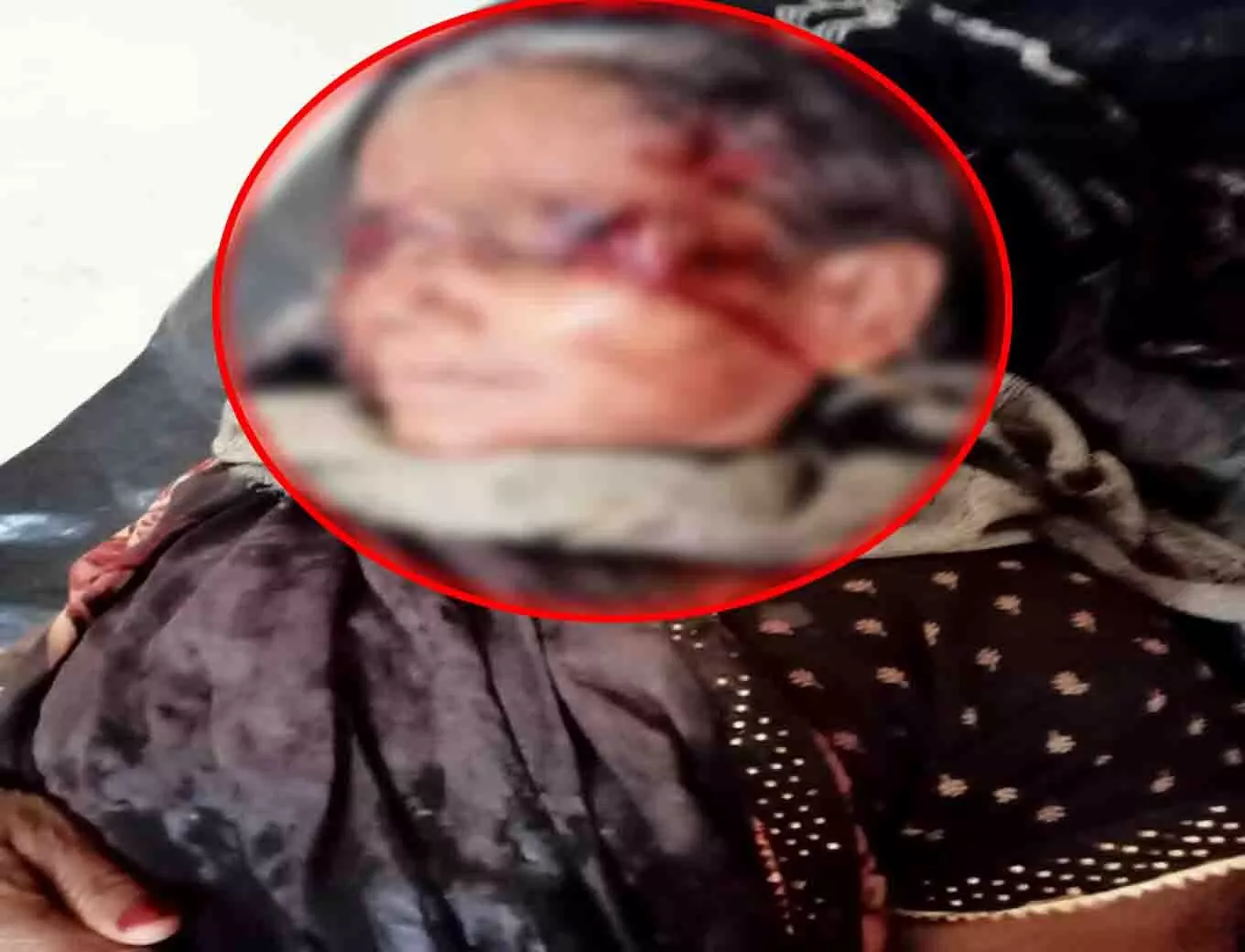 महुआ बिन रही महिला पर सियार ने किया हमला, घायल