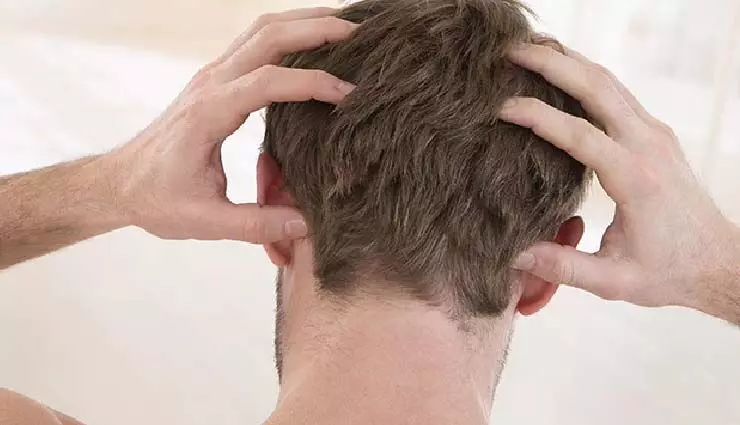 पुरुषों में रूखे बालों को प्रबंधित करने के लिए 3 DIY और प्राकृतिक टिप्स