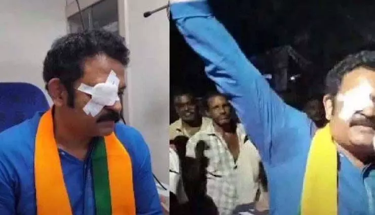 कृष्णकुमार की आंख में चोट पुलिस को पता चला कि आरोपी भाजपा कार्यकर्ता