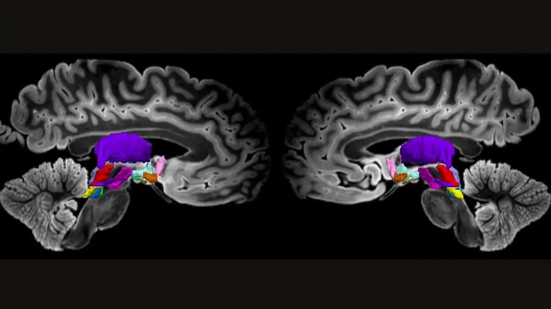 मस्तिष्क कोशिकाओं का अति-विस्तृत मानचित्र जो चेतना की हमारी समझ में कर सकता है सुधार