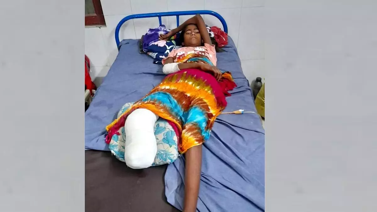 अस्पताल की गलती से 13 साल की बच्ची का काटना पड़ा पैर