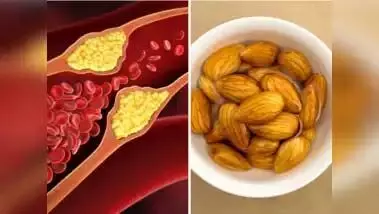 Cholesterol घटाने के लिए करे जीवन में ये 5 बदलाव