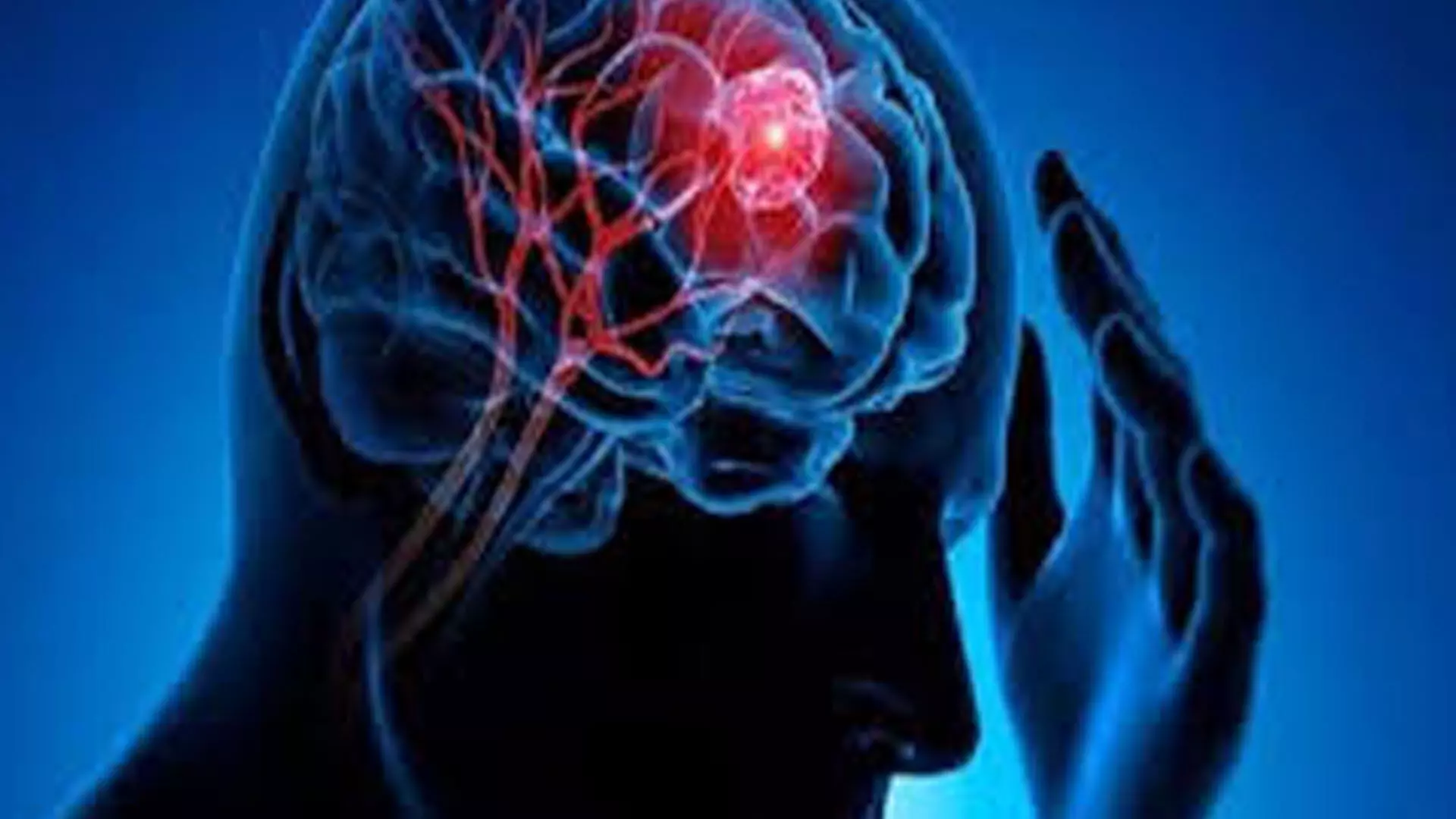 30 वर्षीय व्यक्ति के मस्तिष्क दिमाग से निकाला गया क्रिकेट बॉल साइज का ट्यूमर