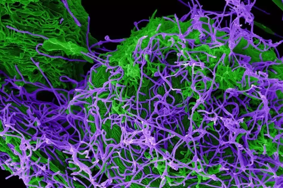 चीनी वैज्ञानिकों ने प्रयोगशाला में उत्परिवर्ती इबोला वायरस बनाया, भयावह लक्षण मिला