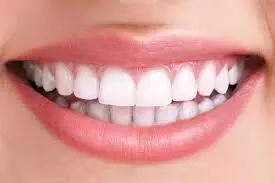 Crooked Teeth Treatment : टेढ़े-मेढ़े दांतों का उपचार है संभव, जाने कैसे ?