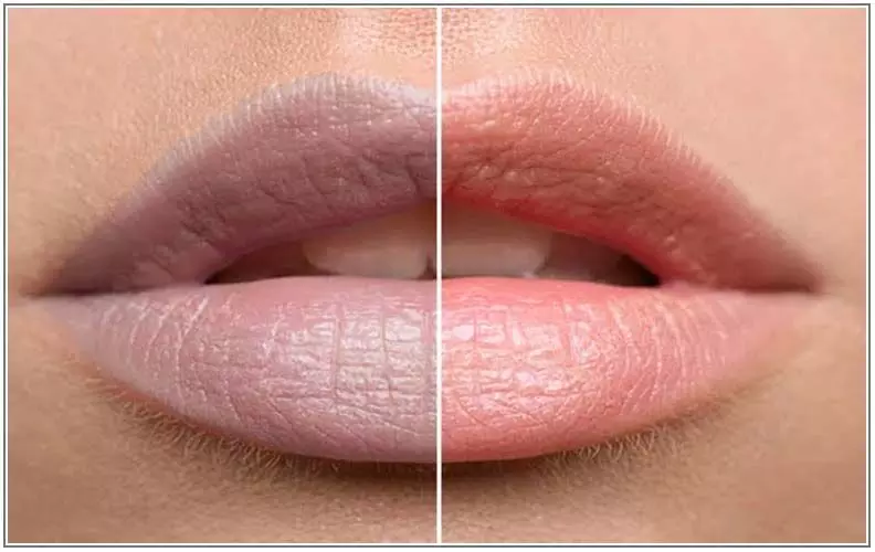 REMIDIES TO TREAT DARK LIPS : क्या आप भी चाहते है काळा होठ से छुटकारा तोह करिये ये घरेलु नुस्खे