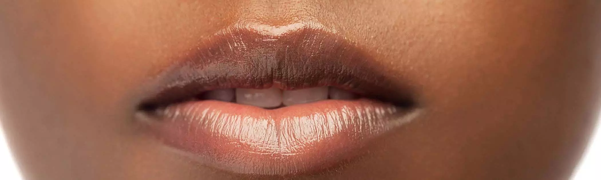 Dark lips: काले होठों का इलाज करें इस उपायों से