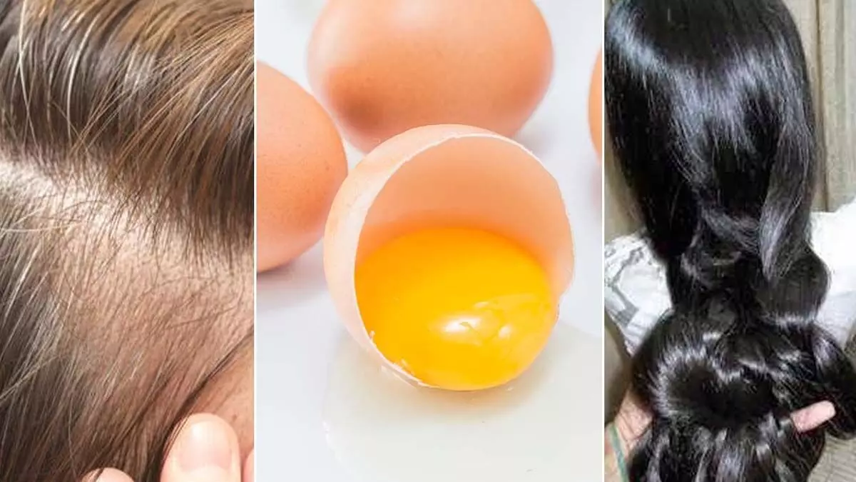 Beuaty: बालों को फायदे पहुंचाता हैं अंडा जानें किस परेशानी में कैसे करें इसका इस्तेमाल