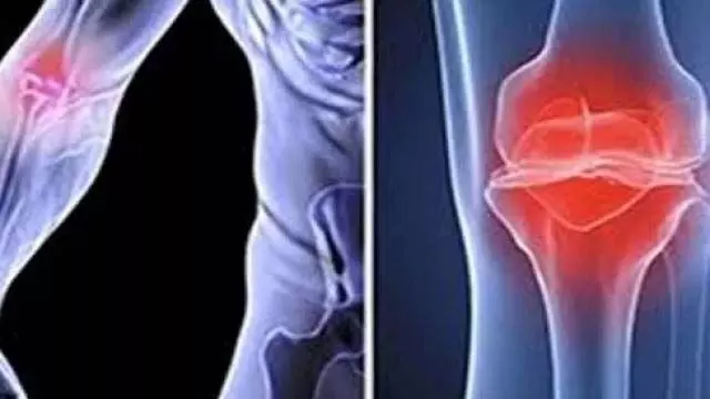 Home Remedies to Increase Bone Density: घर पर बोन डेंसिटी इन नुस्खों से बढ़ाएँ