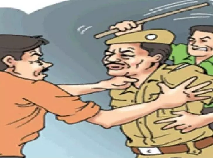 Lucknow: अयोध्या रोड पर नेशनल शूटर ने पिस्टल की बट से ड्राइवर को पीटा
