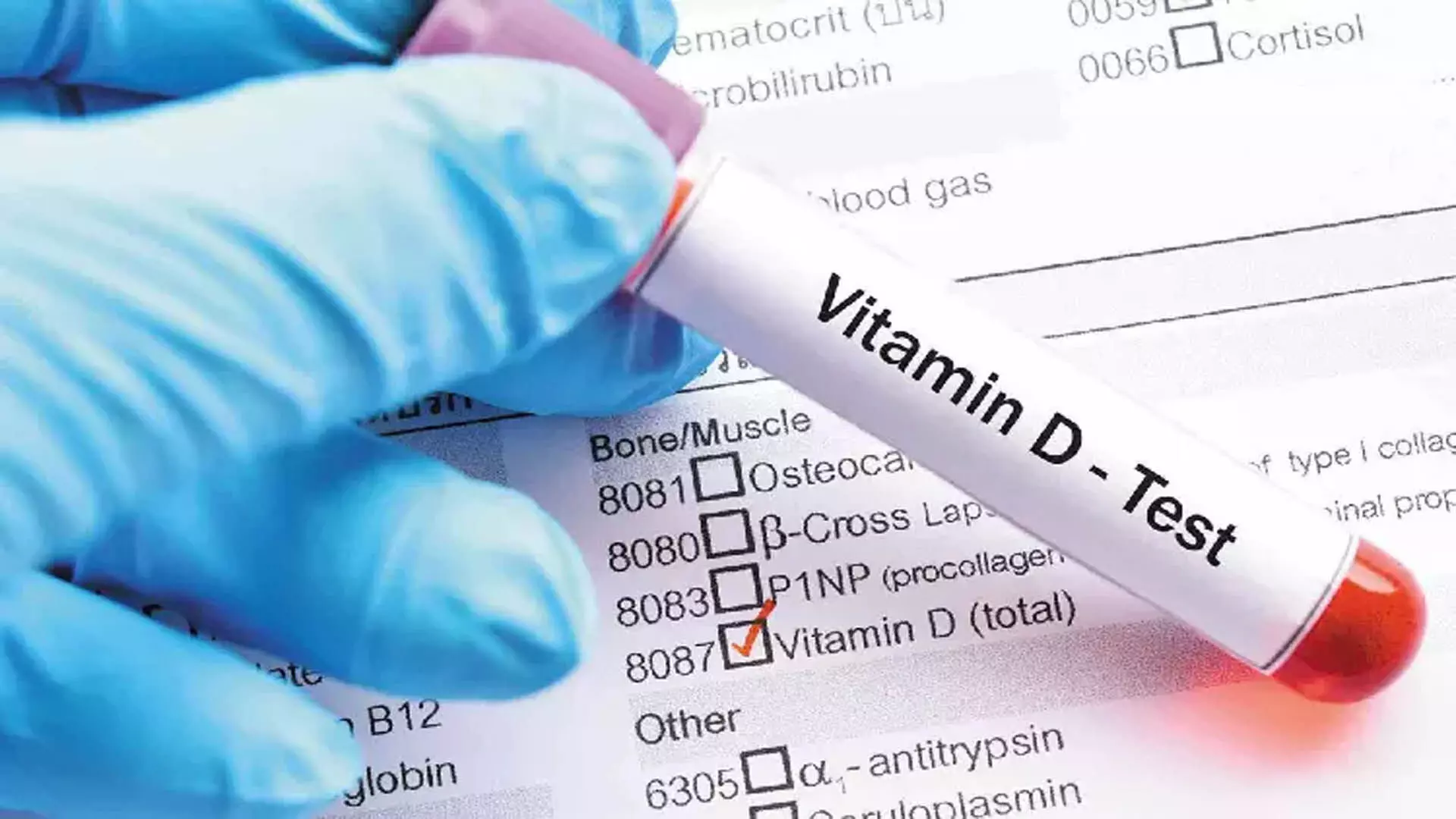 Vitamin D कोई स्क्रीनिंग टेस्ट नहीं है, इसकी नियमित जांच की जरूरत नहीं- डॉक्टर