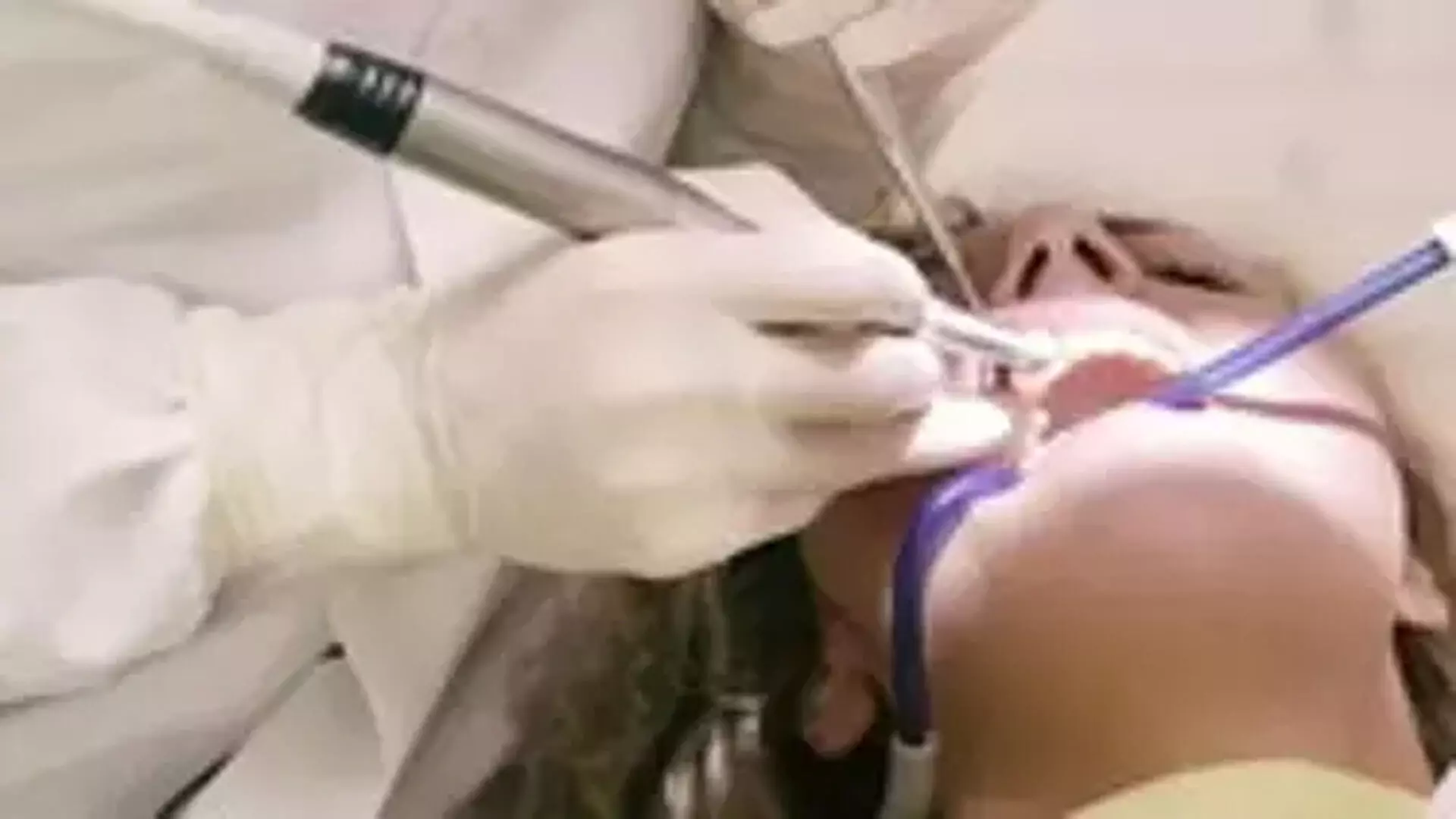 Cosmetic Dentistr: वीनियर, इम्प्लांट और पीड़ादायक दर्द