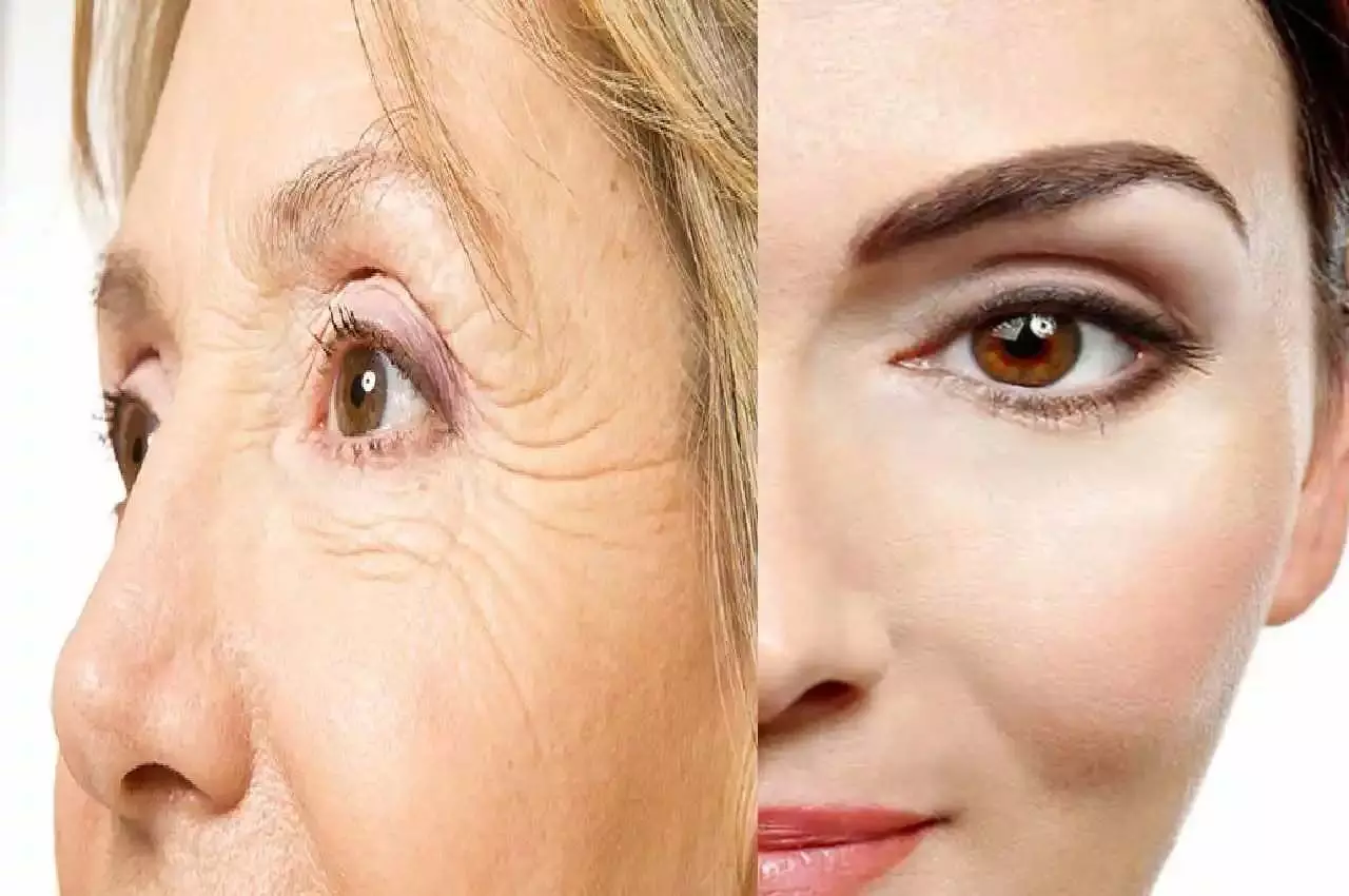 Facial Skin Tips: चेहरे की स्किन में कसाव लाने के लिए अपनाएं ये टिप्स