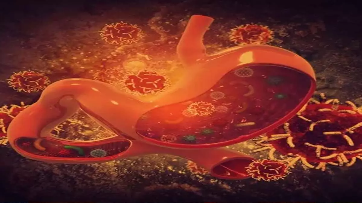 Malignant cells ; विकसित हो सकती हैं पेट की परत पर  कैंसर जैसी घातक कोशिकाएँ