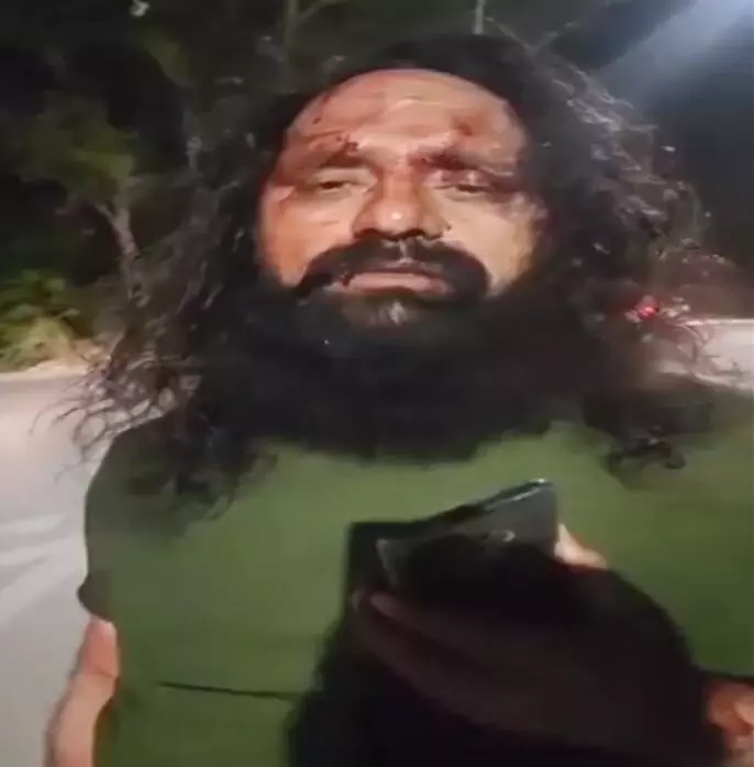 Breaking: सिख युवक को ईट से कुचला, वायरल हुआ VIDEO...