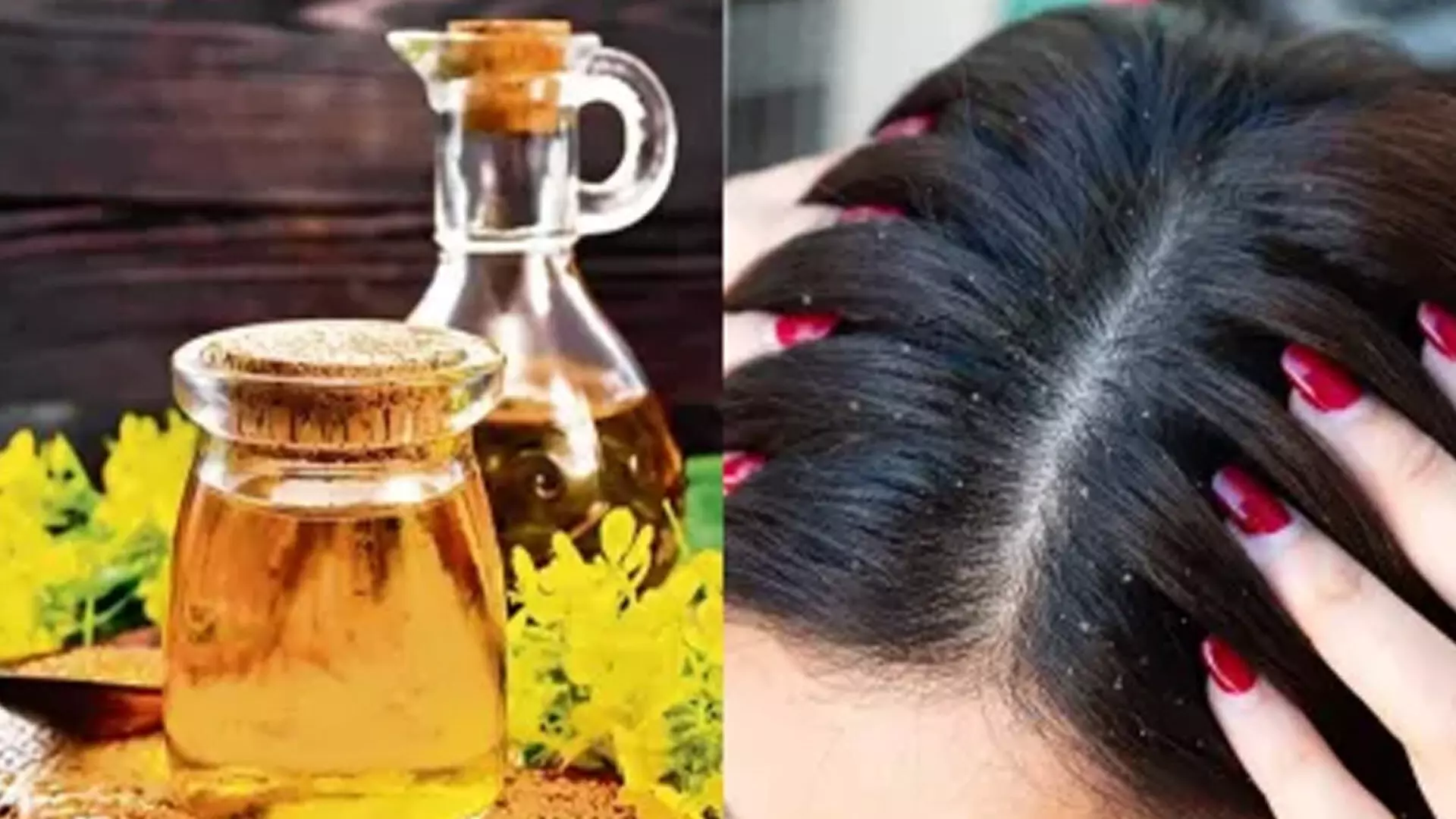 Hair Oil: तेल में मिलाकर लगाएं ये चीजें बालों की तमाम समस्याएं होगी दूर
