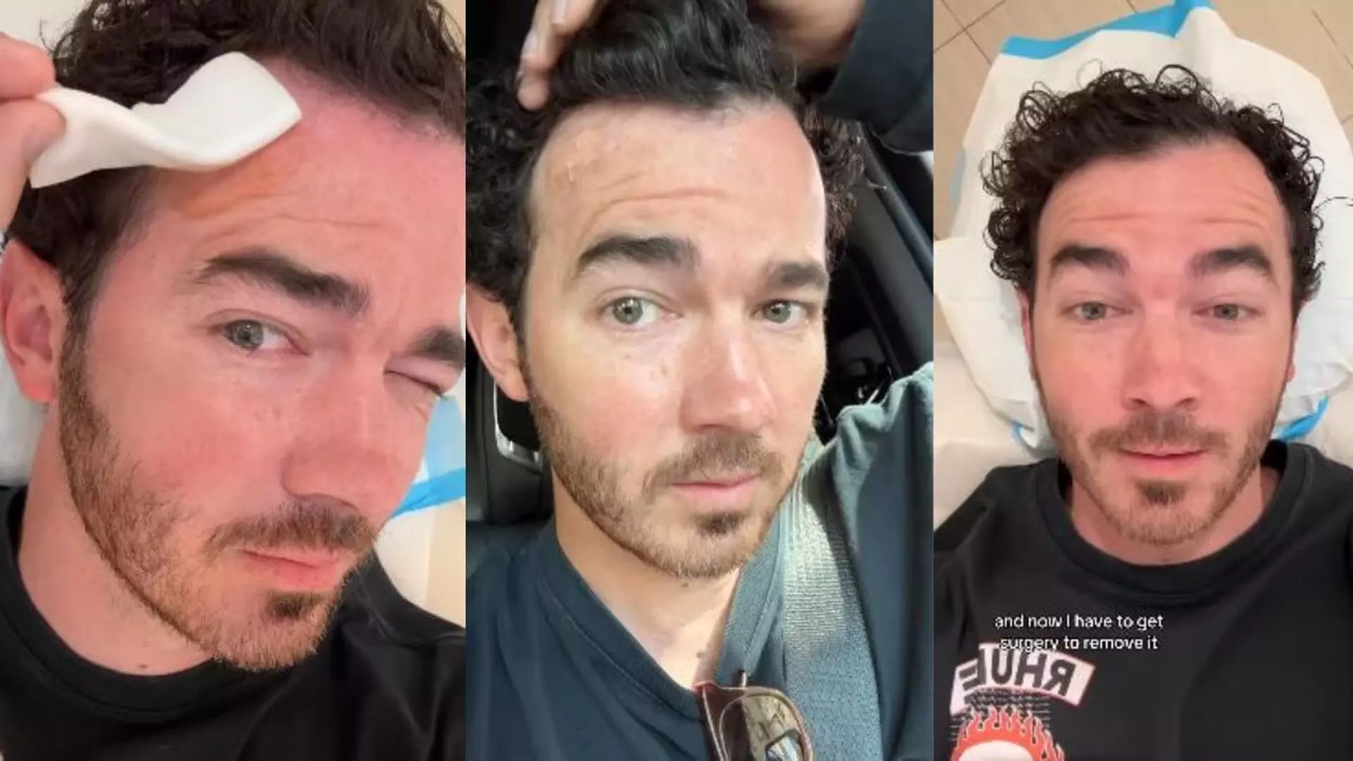 Kevin Jonas ने कराई स्किन कैंसर की सर्जरी, शेयर की हेल्थ अपडेट