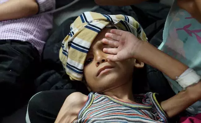 Gaza: में 5 वर्ष से कम आयु के 8,000 से अधिक बच्चों का हुआ कुपोषण का इलाज
