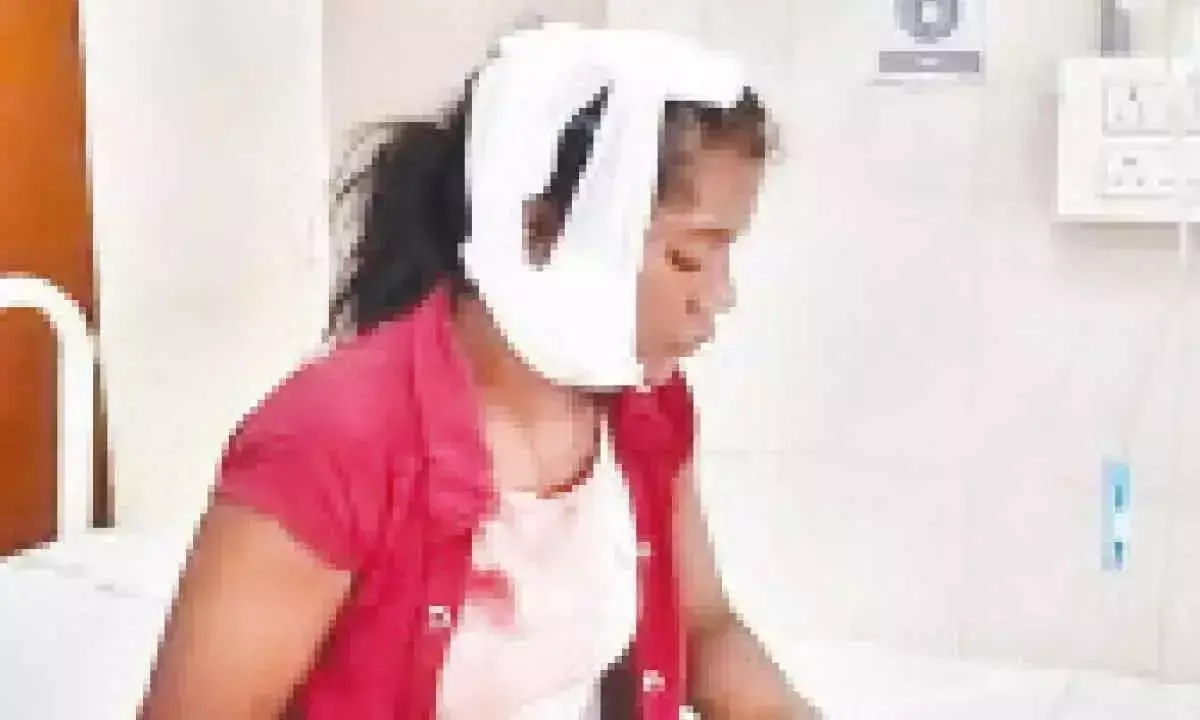 Andhra Pradesh: तेंदुए के हमले में महिला मजदूर घायल
