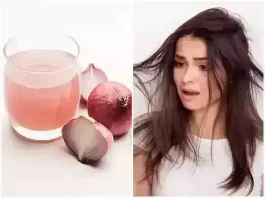 Lifestyle: बालों में प्याज का रस लगाने से फायदे के साथ नुकसान भी होता है, जाने डिटेल में