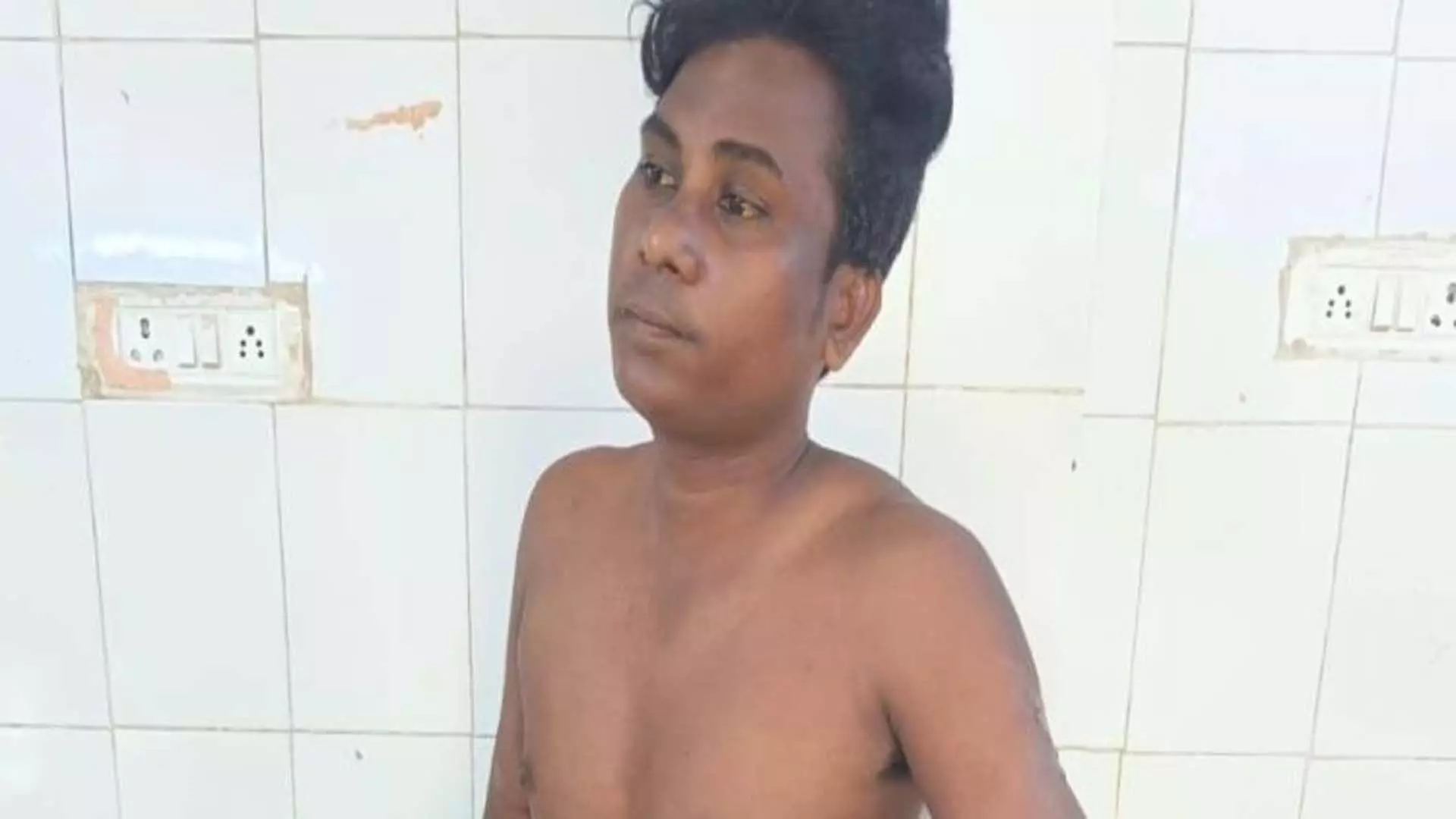 Odisha News: 30 रुपये को लेकर हुई हाथापाई नशे में धुत भाई-बहन गंभीर रूप से झुलस गए