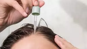 Vitamin for hair: जानिए हेयर ग्रोथ के लिए सबसे अच्छी विटामिन कौन कौन सी हैं