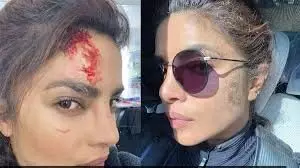 Entertainment: प्रियंका चोपड़ा को लगी गर्दन पर चोट, शूटिंग के दौरान एक्ट्रेस के साथ हुआ हादसा