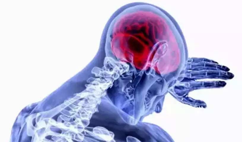 dementia ; क्या है आखिर मस्तिष्क का मनोभ्रंश