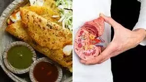 Lifestyle: भूलकर भी न खाएं ये फूड आइटम्स Chronic Kidney Disease में