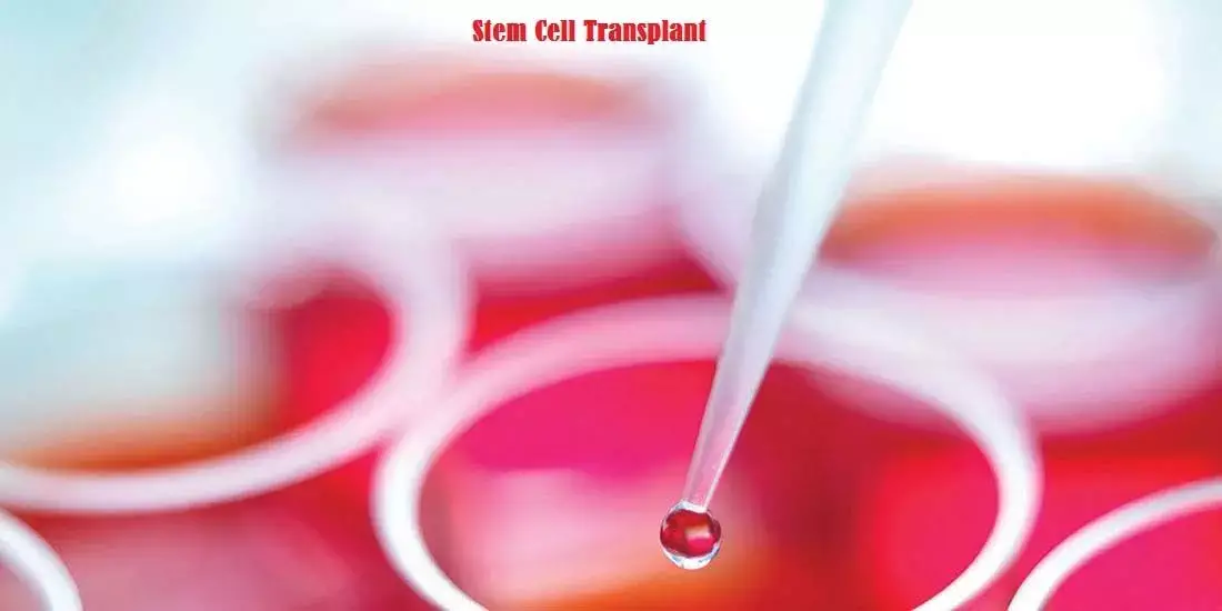 Stem cell transplant ब्लड कैंसर के इलाज में कितना असरदार