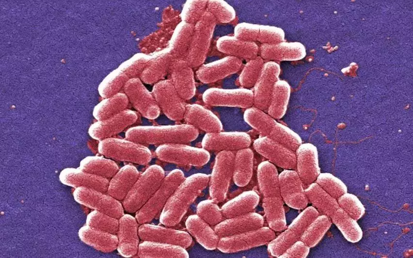 KERALA NEWS : डीएलएफ जल प्रदूषण कक्कनाड अपार्टमेंट से एकत्र नमूनों में कोलीफॉर्म बैक्टीरिया पाया गया