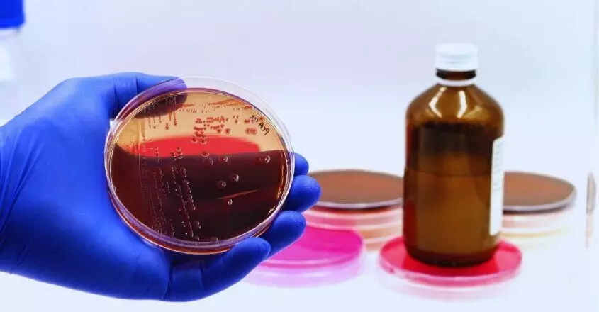 KERALA NEWS : कोच्चि डीएलएफ के पानी के नमूनों में कोलीफॉर्म बैक्टीरिया की मौजूदगी की पुष्टि हुई