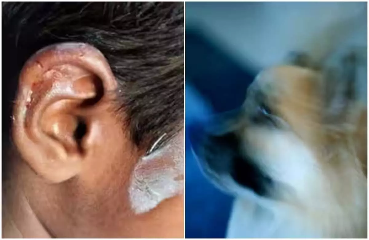 Bengaluru: कुत्ते ने 5 साल के बच्चे का काटा कान  पालतू जानवरों पर छिड़ी ऑनलाइन बहस