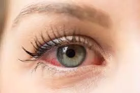 Life Style: आंखों में महसूस होती है ड्राईनेस, तो शरीर में हो सकती है  विटामिन की कमी