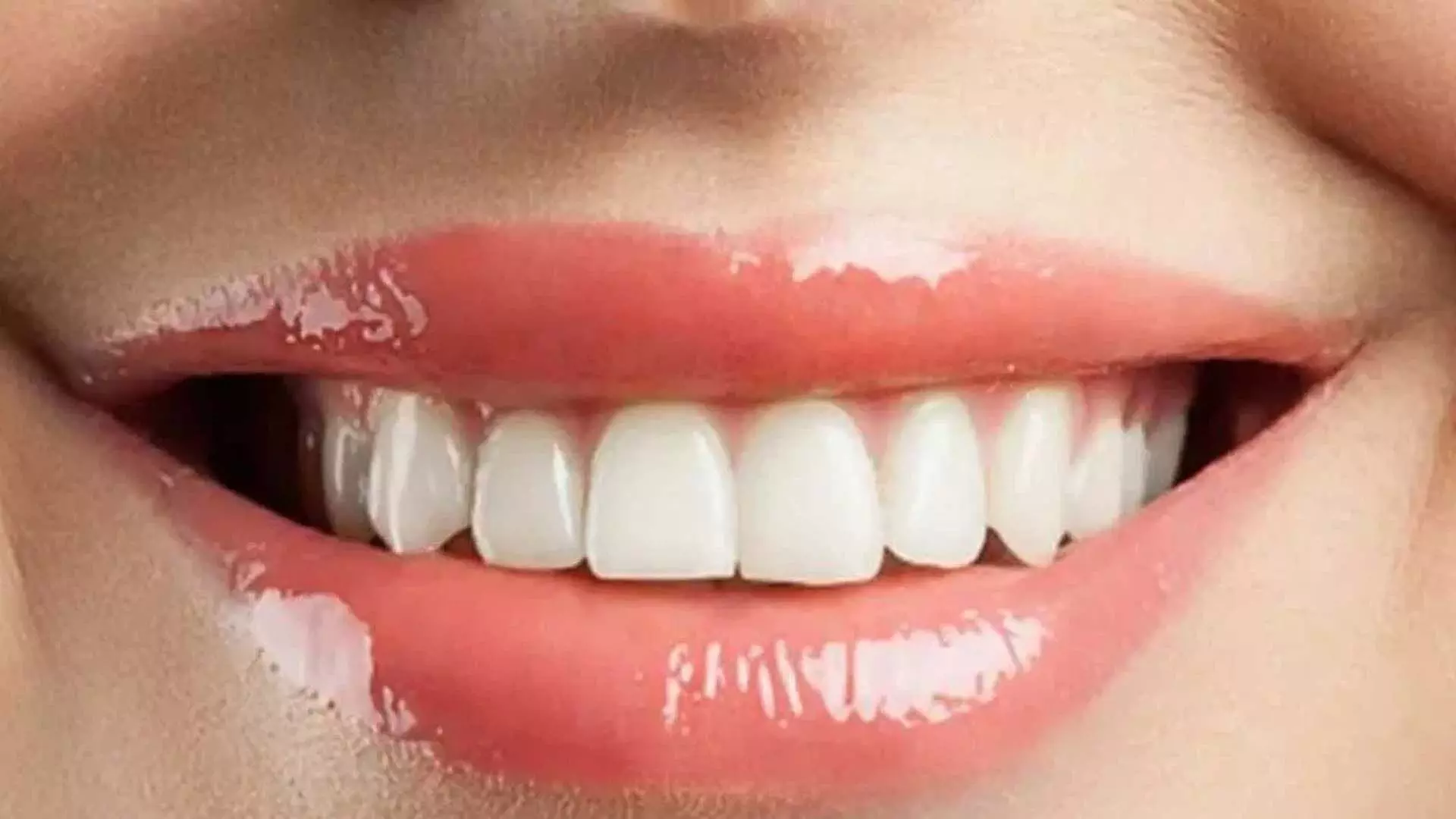 Yellowing of teeth: इन घरेलू नुस्खों की मदद से मिनटों में दूर हो जाएगा दांतों का पीलापन