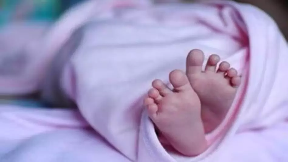 ASSAM NEWS :  सिलचर में जन्मे दुर्लभ जुड़वाँ बच्चे, जन्म के कुछ समय बाद ही मर गए