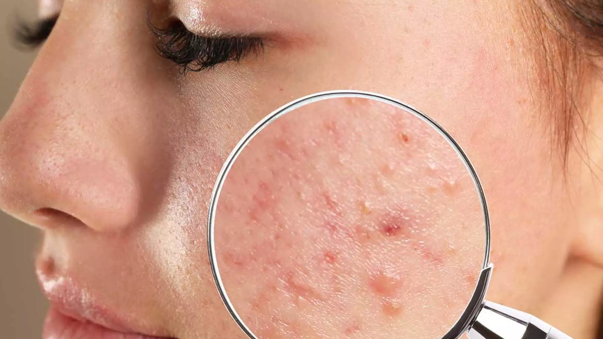 Oily Skin: भूलकर भी ना करें ये 5 गलतियां पिंपल और दाग-धब्बों से भर जाएगा चेहरा