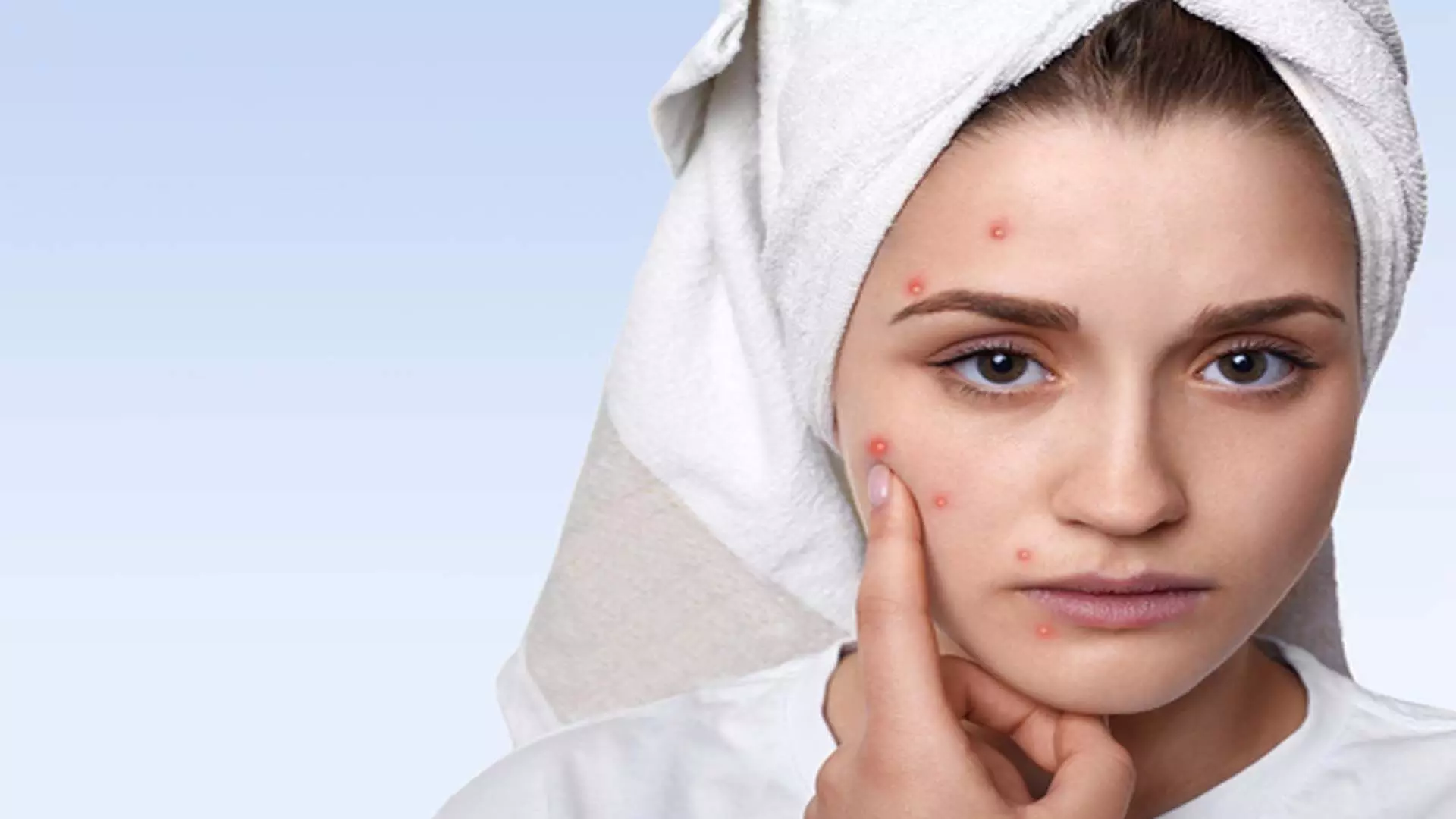 Pimple: खाली पेट इन चीजों का करे सेवन चेहरे को पिंपल और दाग धब्बों से दिलाए निजात
