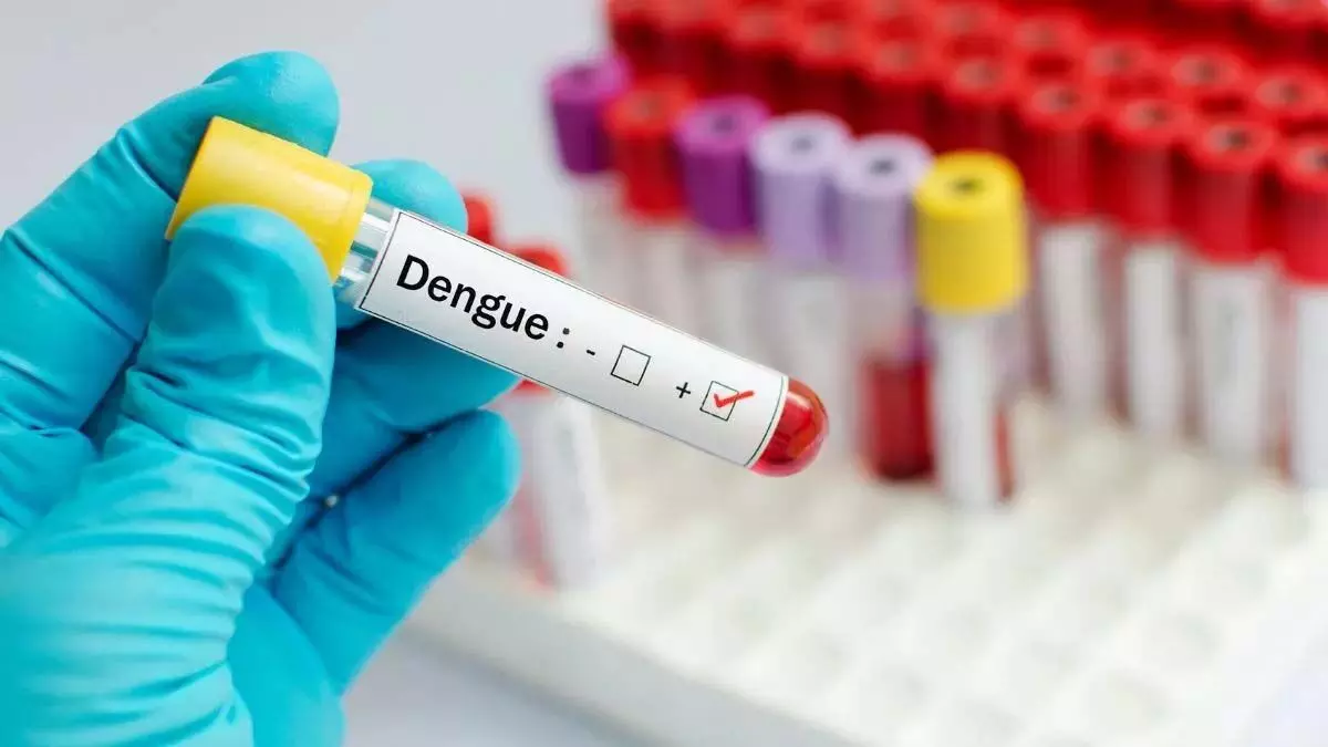 dengue death : बेंगलुरू में  डेंगू से पहली मौत की सूचना