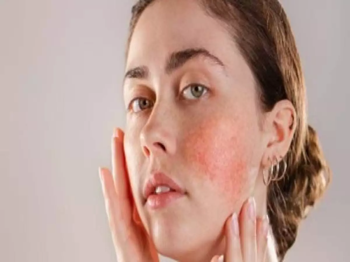 Skin Care: त्वचा को धूप से बचाने के लिए करें ये 5 उपाय