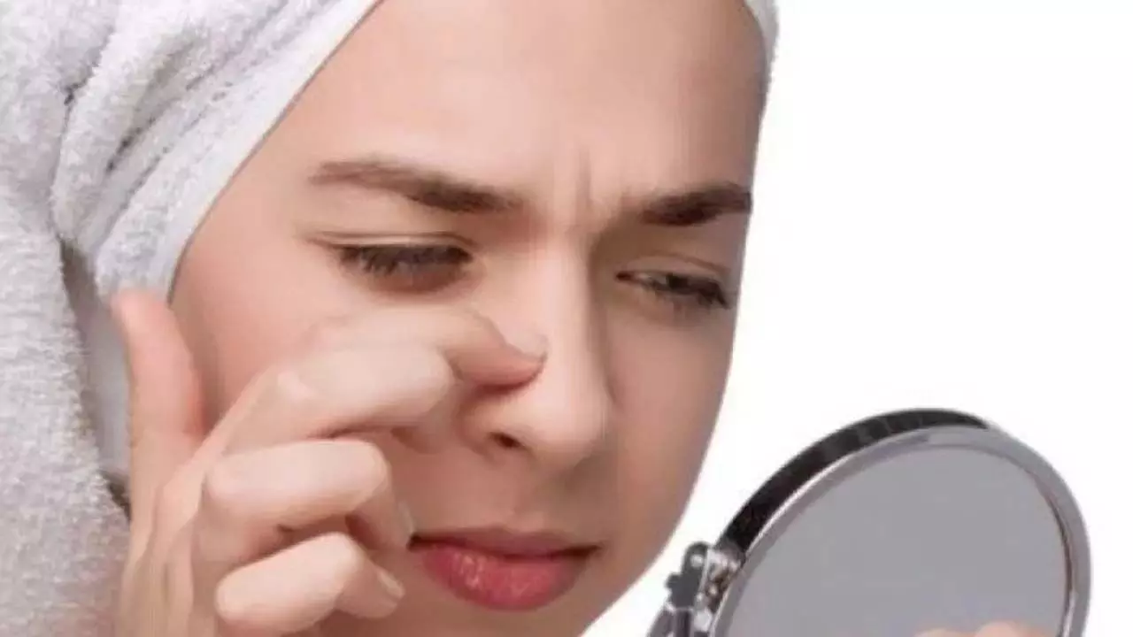 Home remedies: नाक पर से तेल हटाने के 5 तरीके आजमाए